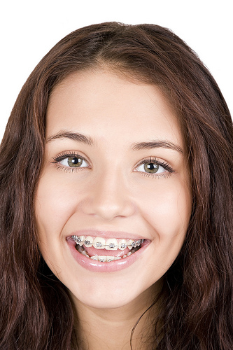 Orthodontic braces teen smiling