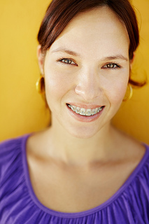 Woman with braces, orthodontic consultation