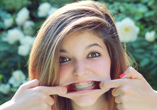 Why Orthodontic treatment is important